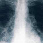 Neonatal: según su abogado, Brenda Agüero habría advertido irregularidades