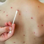 La OEA advirtió sobre el colapso del sistema democrático de Venezuela